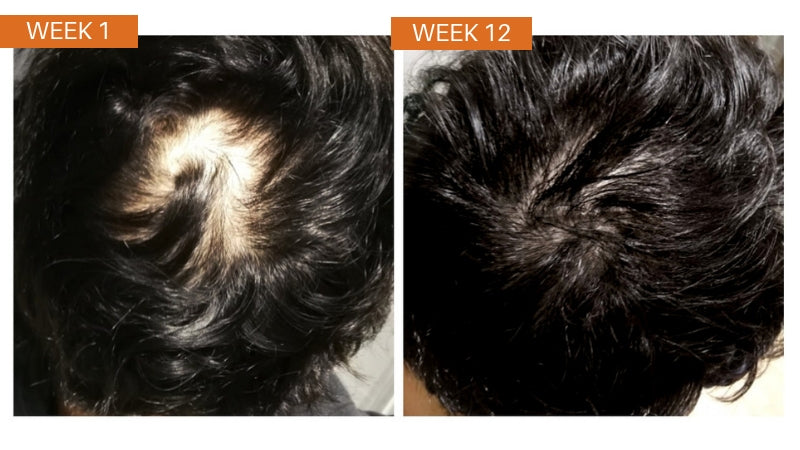 Viora Pumpkin Seed Oil + Saw Palmetto