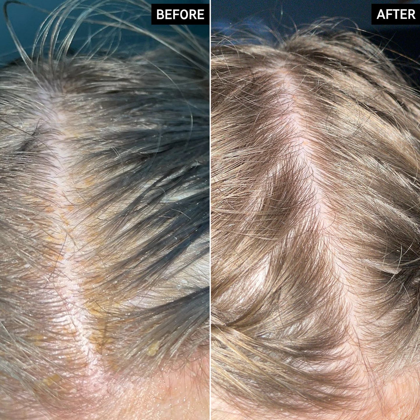 Viora Pumpkin Seed Oil + Saw Palmetto