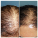 Viora Pumpkin Seed Oil + Saw Palmetto