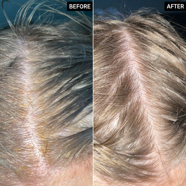Viora Pumpkin Seed Oil + Saw Palmetto