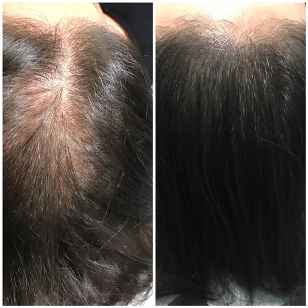 Viora Pumpkin Seed Oil + Saw Palmetto